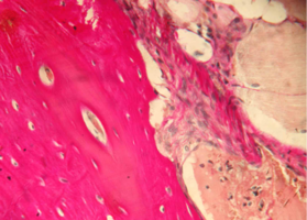 Рис. 10. Нижняя челюсть кролика на 90 сутки после остеопластики справа