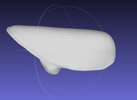 Особенности применения аутогенных костных трансплантатов и индивидуальных аллогенных костных имплантатов