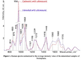  Raman spectra normalized to the average intensity value of the mineralized samples of bioimplants.