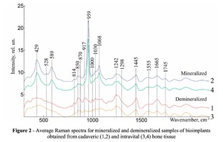 Average Raman spectra for mineralized and demineralized samples of bioimplants obtained from cadaveric (1,2) and intravital (3,4) bone tissue