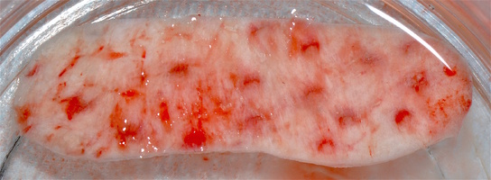 Рис. 4г. Гидратированный трансплантат ТМО (dura mater)