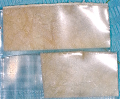 Рис. 4б. Мукопластический материал ТМО (dura mater)