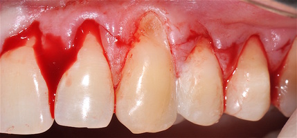 Рис. 5а. Дизайн разреза 