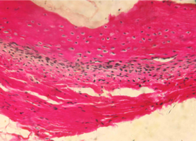 Рис. 8. Нижняя челюсть кролика на 30 сутки после остеопластики справа