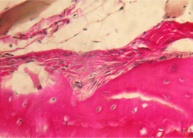 Рис. 11. Нижняя челюсть кролика на 150 сутки после остеопластики слева