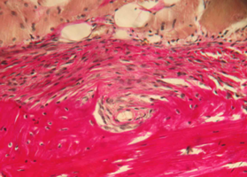 Рис. 12. Нижняя челюсть кролика на 150 сутки после остеопластики справа