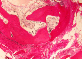 Рис. 13. Нижняя челюсть кролика на 270 сутки после остеопластики слева