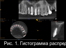 Рис. 1. Гистограмма распределения плотности на дентальной компьютерной томографии фронтального отдела верхней челюсти