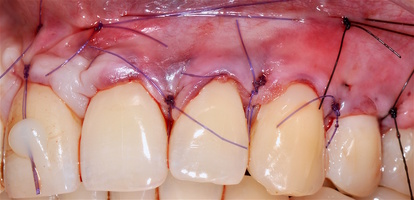 Рис. 5й. Дизайн разреза